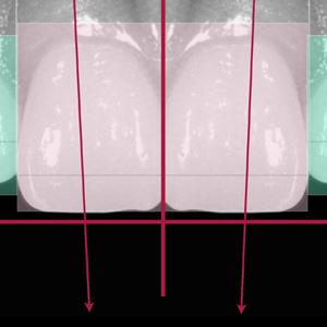 Analyse et diagnostic esthétique