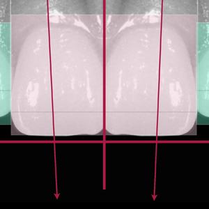 Analyse et diagnostic esthétique