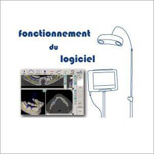 Fonctionnement du logiciel de planification 3D ROBODENT