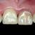 Eclaircissement unitaire